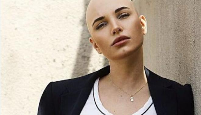 Дарина Митченко "потеряла" волосы после второй химиотерапии Дарина Митченко "потеряла" волосы после второй химиотерапии