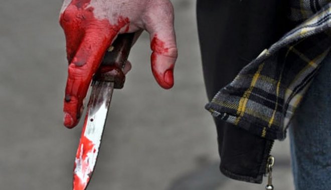 Пострадавший находится в тяжелом состоянии. Фото: dpchas.com.ua