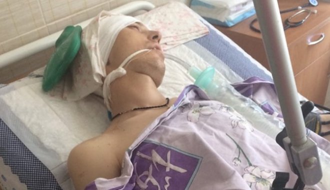 Максим Кибалко в больнице. Фото: Facebook Наталья Коваленко